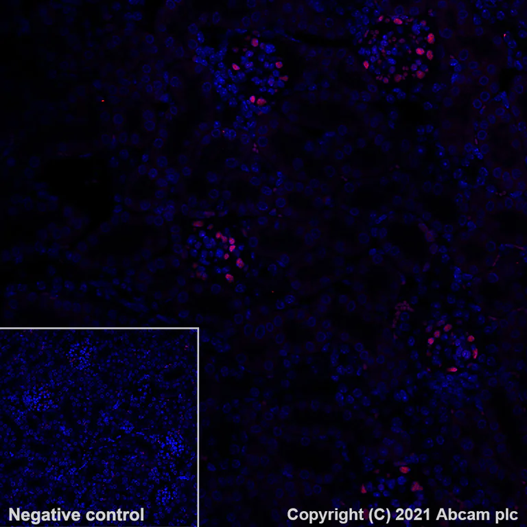 Immunohistochemistry (Formalin/PFA-fixed paraffin-embedded sections) - Alexa Fluor® 647 Anti-Wilms Tumor Protein antibody [EPR23963-116] (AB283325)