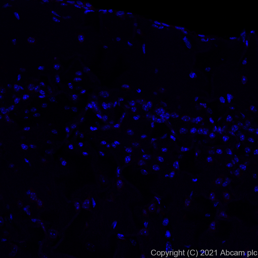 Immunohistochemistry (Formalin/PFA-fixed paraffin-embedded sections) - Alexa Fluor® 647 Anti-Wilms Tumor Protein antibody [EPR23963-116] (AB283325), expandable thumbnail