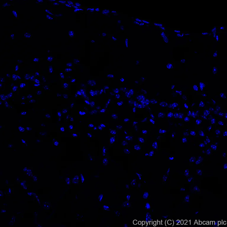Immunohistochemistry (Formalin/PFA-fixed paraffin-embedded sections) - Alexa Fluor® 647 Anti-Wilms Tumor Protein antibody [EPR23963-116] (AB283325)