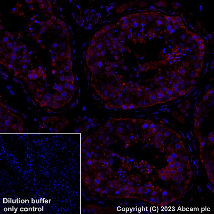 Immunohistochemistry (Formalin/PFA-fixed paraffin-embedded sections) - Alexa Fluor® 647 Anti-YTHDF2 antibody [EPR23544-19] (AB315261), expandable thumbnail