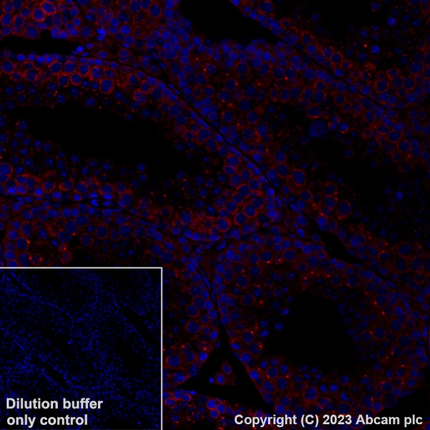 Immunohistochemistry (Formalin/PFA-fixed paraffin-embedded sections) - Alexa Fluor® 647 Anti-YTHDF2 antibody [EPR23544-19] (AB315261), expandable thumbnail