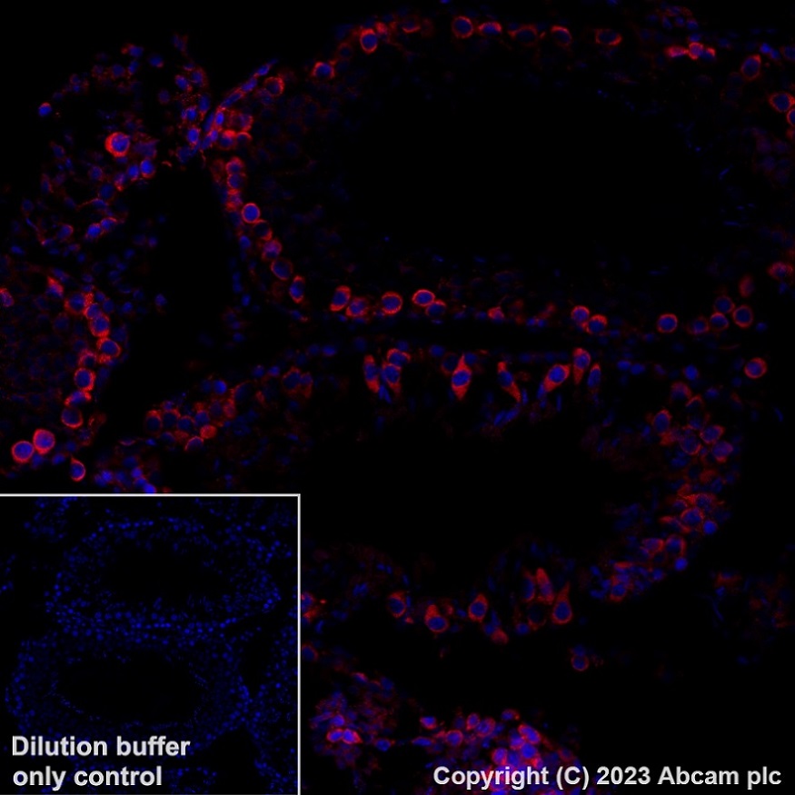 Immunohistochemistry (Formalin/PFA-fixed paraffin-embedded sections) - Alexa Fluor® 647 Anti-YTHDF2 antibody [EPR23544-19] (AB315261), expandable thumbnail