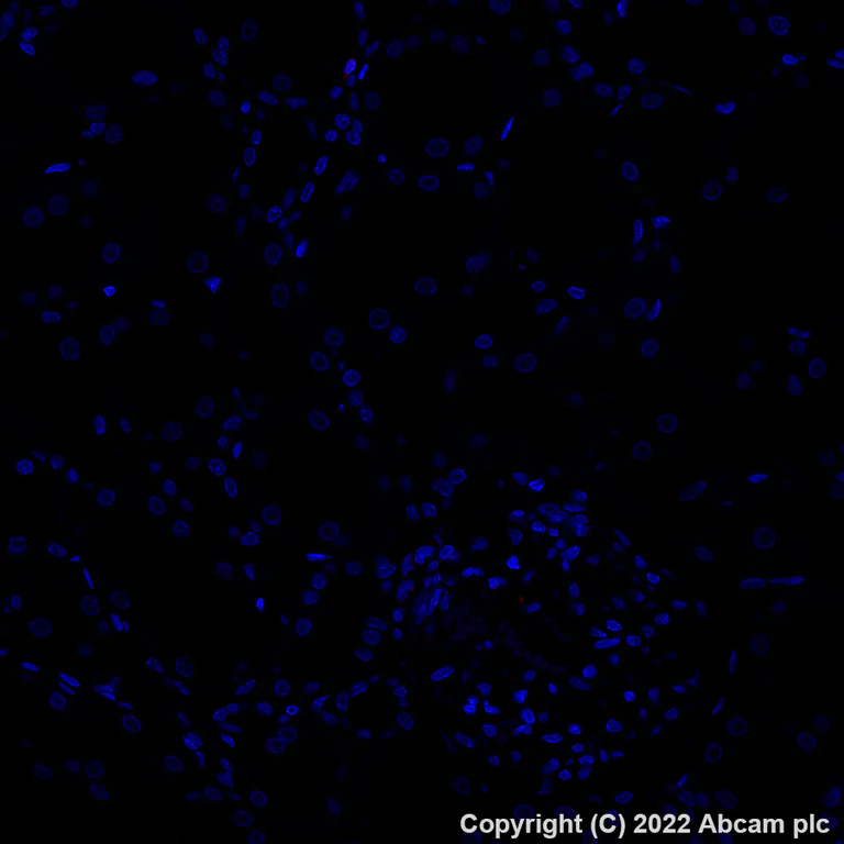 Immunohistochemistry (Formalin/PFA-fixed paraffin-embedded sections) - Alexa Fluor® 647 Anti-ZAP70 antibody [YE291] (AB307382)