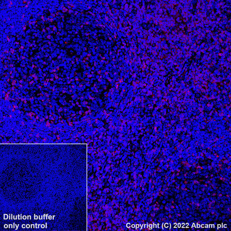 Immunohistochemistry (Formalin/PFA-fixed paraffin-embedded sections) - Alexa Fluor® 647 Anti-ZAP70 antibody [YE291] (AB307382)
