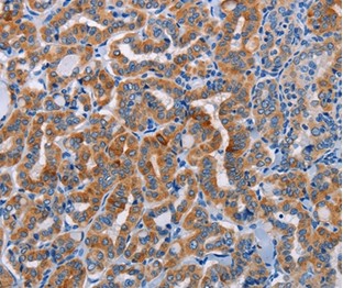 Immunohistochemistry (Formalin/PFA-fixed paraffin-embedded sections) - Anti-ALG12 antibody (AB197830)