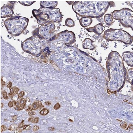 Immunohistochemistry (Formalin/PFA-fixed paraffin-embedded sections) - Anti-ALG3 antibody (AB151211)