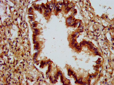 Immunohistochemistry (Formalin/PFA-fixed paraffin-embedded sections) - Anti-ALG9 antibody (AB235083)