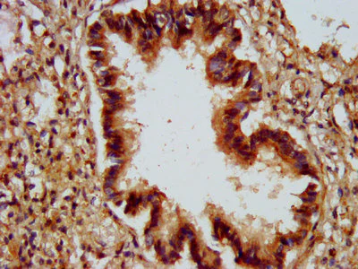 Immunohistochemistry (Formalin/PFA-fixed paraffin-embedded sections) - Anti-ALG9 antibody (AB235083)