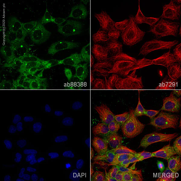 Anti-ALIX antibody (ab88388) | Abcam