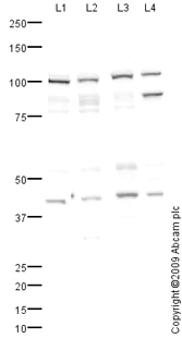 Western blot - Anti-ALIX antibody (AB88388)