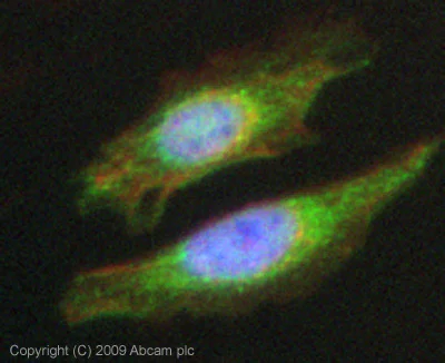 Immunocytochemistry/ Immunofluorescence - Anti-ALK-1 antibody (AB68703)