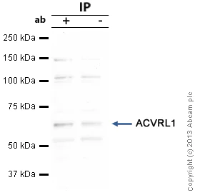 Immunoprecipitation - Anti-ALK-1 antibody (AB68703)