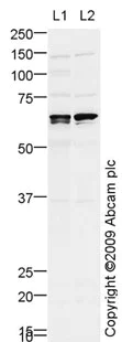 Western blot - Anti-ALK-1 antibody (AB68703)