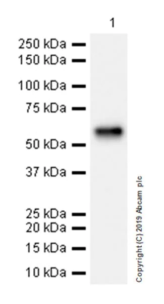 Western blot - Anti-ALK-1 antibody [EPR22985-108] (AB263902)