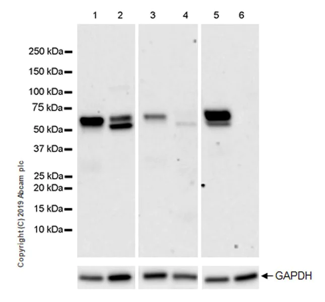 Western blot - Anti-ALK-1 antibody [EPR22985-108] - BSA and Azide free (AB269590)