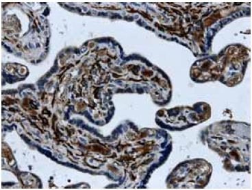 Immunohistochemistry (Formalin/PFA-fixed paraffin-embedded sections) - Anti-ALK-1 antibody [MM0015-8G33] (AB51870)