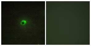 Immunocytochemistry/ Immunofluorescence - Anti-ALK-7 antibody (AB111121)