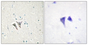 Immunohistochemistry (Formalin/PFA-fixed paraffin-embedded sections) - Anti-ALK-7 antibody (AB111121)