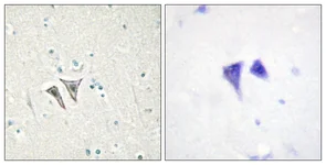 Immunohistochemistry (Formalin/PFA-fixed paraffin-embedded sections) - Anti-ALK-7 antibody (AB111121)