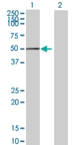 Western blot - Anti-ALK-7 antibody (AB67921)