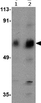 Western blot - Anti-ALK-7 antibody - N-terminal (AB77051)