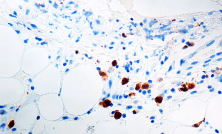Immunohistochemistry (Formalin/PFA-fixed paraffin-embedded sections) - Anti-ALK antibody [5A4] (AB17127)
