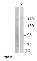 Western blot - Anti-ALK antibody (AB74159)