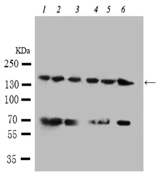 Western blot - Anti-ALK antibody - C-terminal (AB190934)