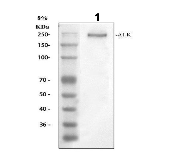 Western blot - Anti-ALK antibody - C-terminal (AB190934)