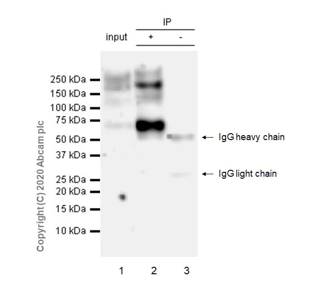 Immunoprecipitation - Anti-ALK antibody [EPR24029-128] - BSA and Azide free (AB275968)