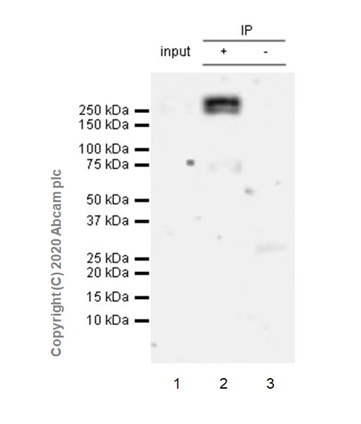 Immunoprecipitation - Anti-ALK antibody [EPR24029-128] - BSA and Azide free (AB275968)