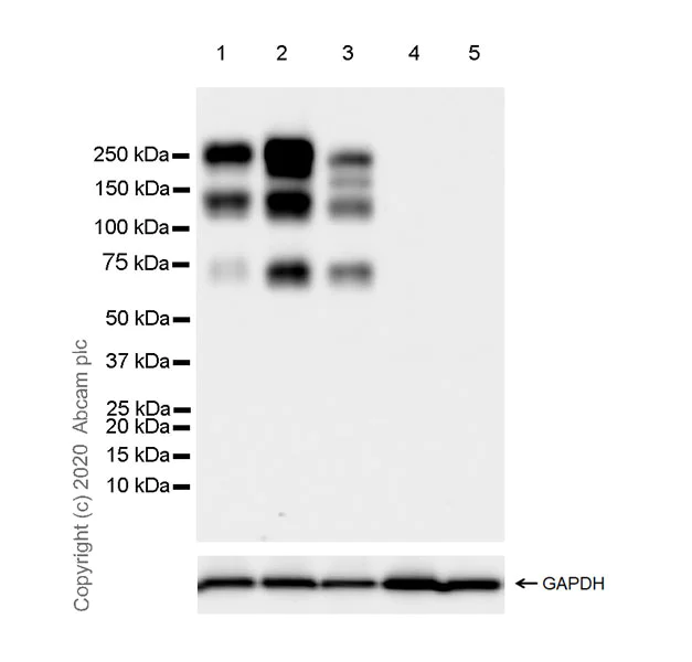 Western blot - Anti-ALK antibody [EPR24029-128] - BSA and Azide free (AB275968)
