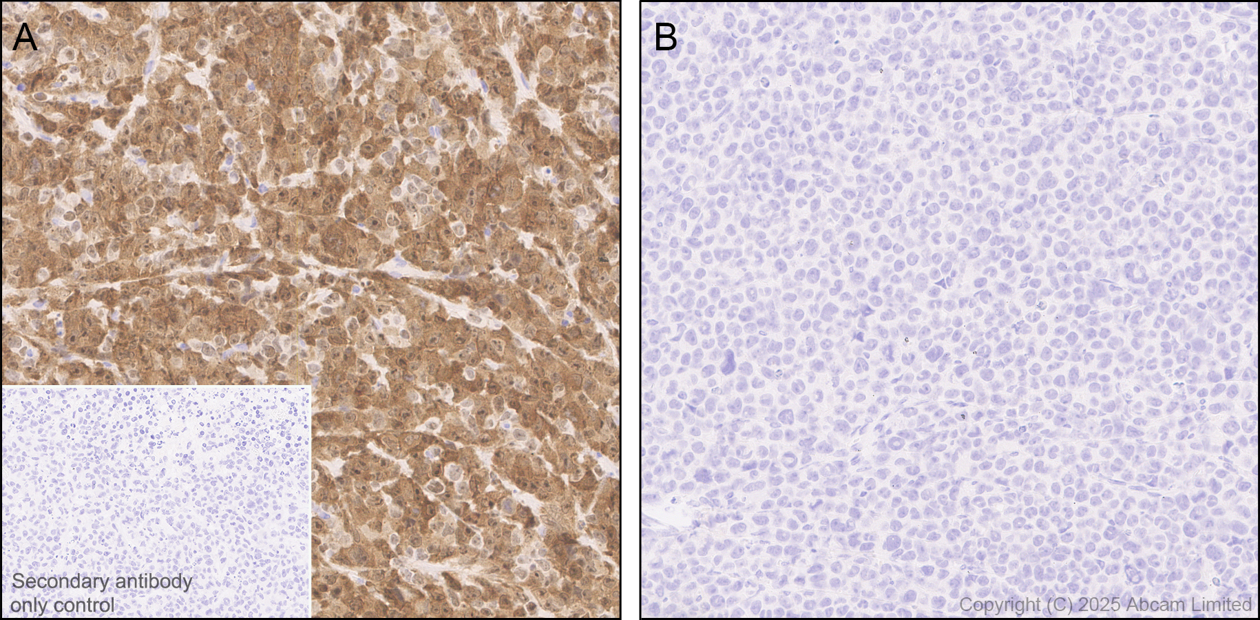 Immunohistochemistry (Formalin/PFA-fixed paraffin-embedded sections) - Anti-ALK antibody [EPR29054-38] (ab323643), expandable thumbnail