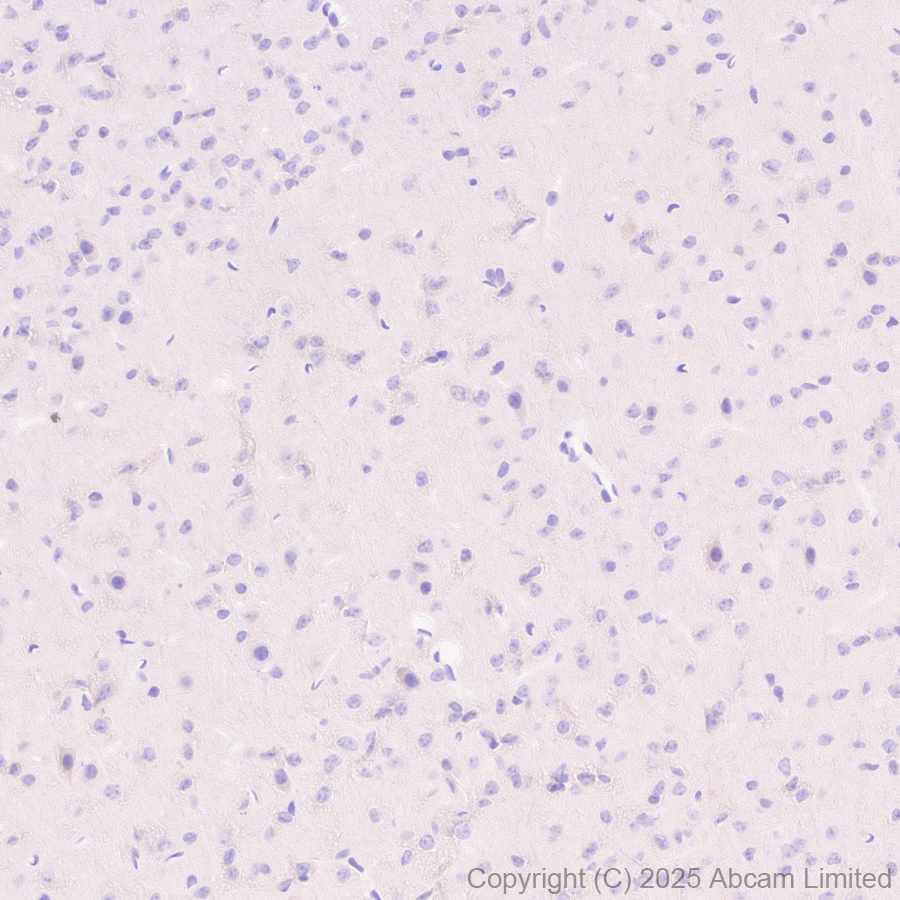 Immunohistochemistry (Formalin/PFA-fixed paraffin-embedded sections) - Anti-ALK antibody [EPR29054-38] (AB323643), expandable thumbnail