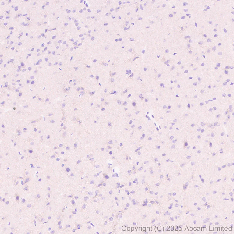 Immunohistochemistry (Formalin/PFA-fixed paraffin-embedded sections) - Anti-ALK antibody [EPR29054-38] (AB323643)