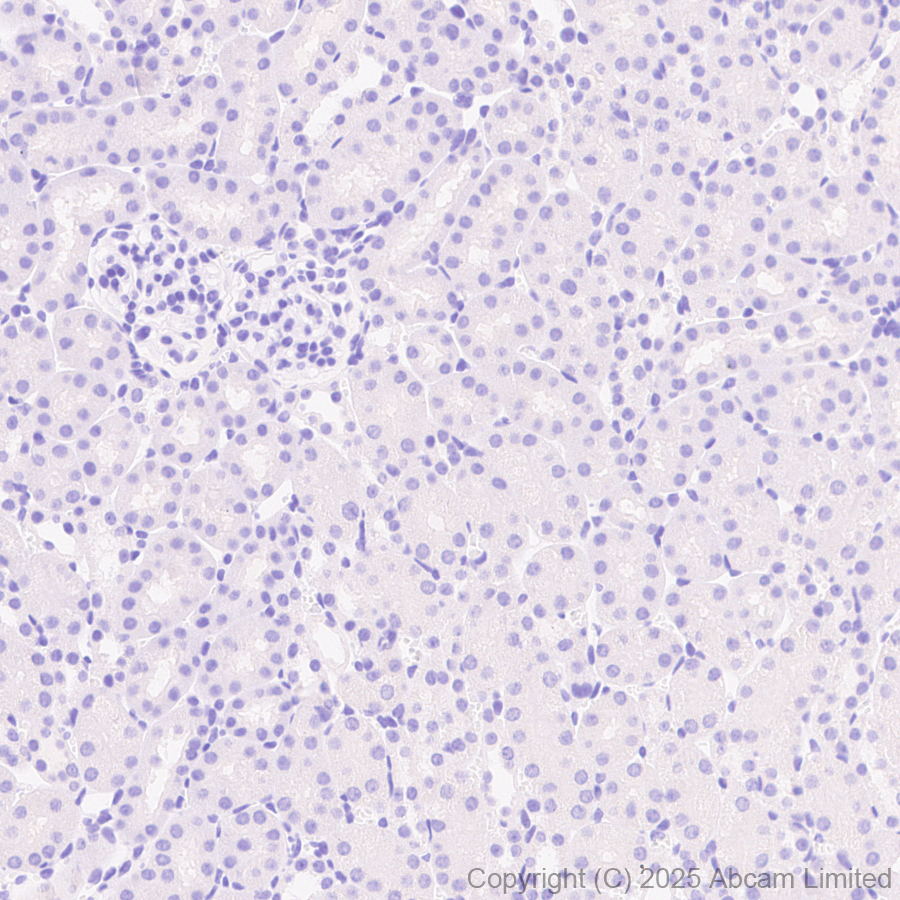 Immunohistochemistry (Formalin/PFA-fixed paraffin-embedded sections) - Anti-ALK antibody [EPR29054-38] (AB323643), expandable thumbnail