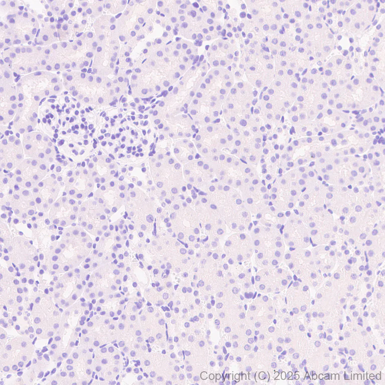 Immunohistochemistry (Formalin/PFA-fixed paraffin-embedded sections) - Anti-ALK antibody [EPR29054-38] (AB323643)