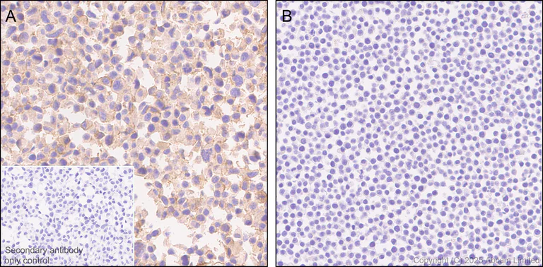 Immunohistochemistry (Formalin/PFA-fixed paraffin-embedded sections) - Anti-ALK antibody [EPR29054-38] (AB323643)