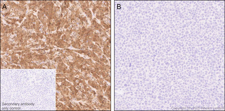 Immunohistochemistry (Formalin/PFA-fixed paraffin-embedded sections) - Anti-ALK antibody [EPR29054-38] - BSA and Azide free (AB326601)