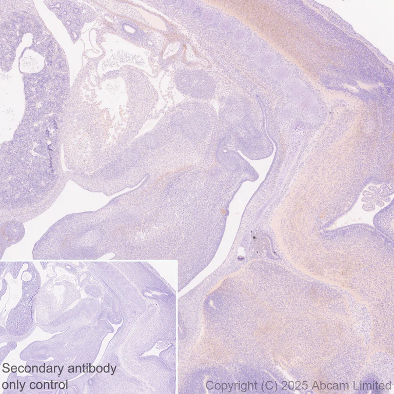 Immunohistochemistry (Formalin/PFA-fixed paraffin-embedded sections) - Anti-ALK antibody [EPR29054-38] - BSA and Azide free (AB326601)