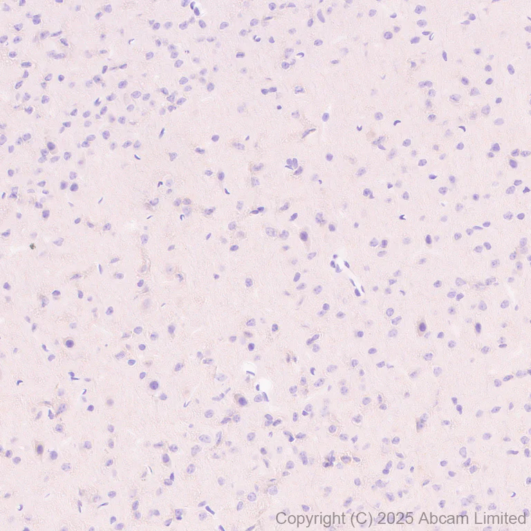 Immunohistochemistry (Formalin/PFA-fixed paraffin-embedded sections) - Anti-ALK antibody [EPR29054-38] - BSA and Azide free (AB326601)