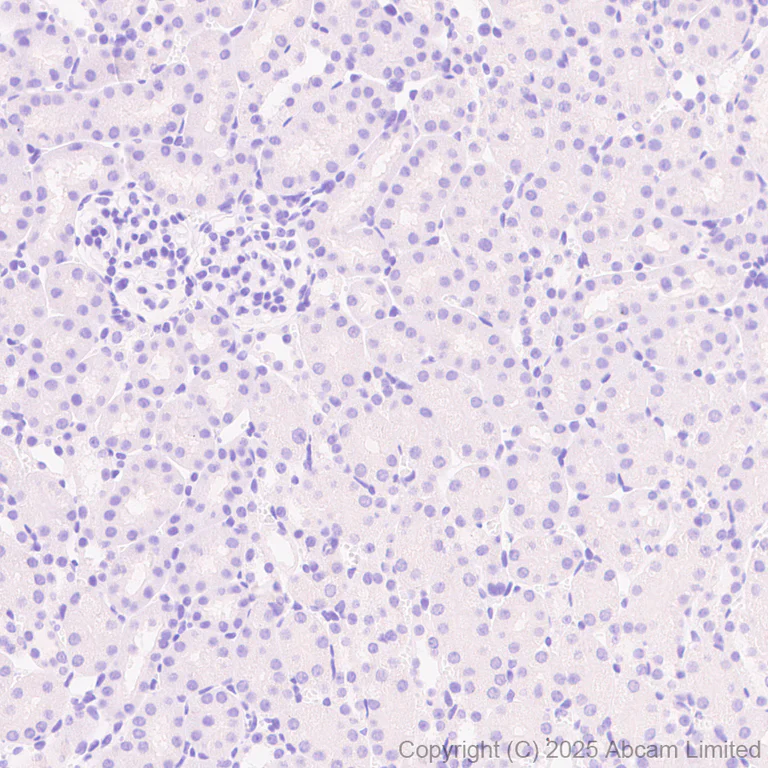 Immunohistochemistry (Formalin/PFA-fixed paraffin-embedded sections) - Anti-ALK antibody [EPR29054-38] - BSA and Azide free (AB326601)