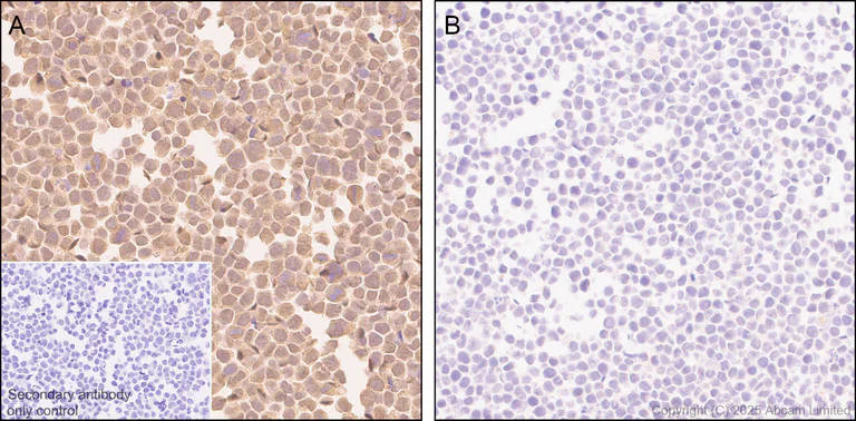 Immunohistochemistry (Formalin/PFA-fixed paraffin-embedded sections) - Anti-ALK antibody [EPR29054-38] - BSA and Azide free (AB326601)