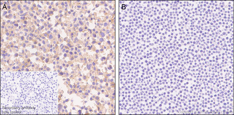 Immunohistochemistry (Formalin/PFA-fixed paraffin-embedded sections) - Anti-ALK antibody [EPR29054-38] - BSA and Azide free (AB326601)