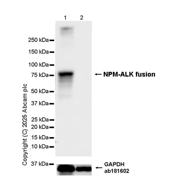 Western blot - Anti-ALK antibody [EPR29054-38] - BSA and Azide free (AB326601)