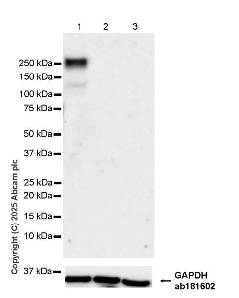 Western blot - Anti-ALK antibody [EPR29054-38] - BSA and Azide free (AB326601)