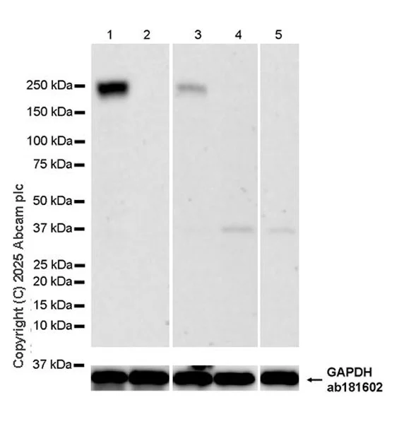 Western blot - Anti-ALK antibody [EPR29054-38] - BSA and Azide free (AB326601)