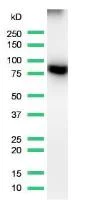 Western blot - Anti-ALK antibody [SP144] (AB183332)