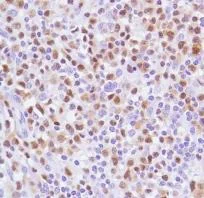 Immunohistochemistry (Formalin/PFA-fixed paraffin-embedded sections) - Anti-ALK antibody [SP144] - BSA and Azide free (AB271941)