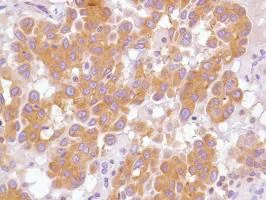 Immunohistochemistry (Formalin/PFA-fixed paraffin-embedded sections) - Anti-ALK antibody [SP144] - BSA and Azide free (AB271941)